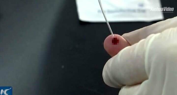 <p>İlk aşamada parmak ucundan alınan kan, test kitine aktarılıyor.</p>
