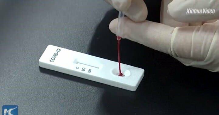 <p>Test kitine koyulan kan ile birlikte 15 dakika içerisinde kanda koronavirüsün olup olmadığı anlaşılıyor.</p>
